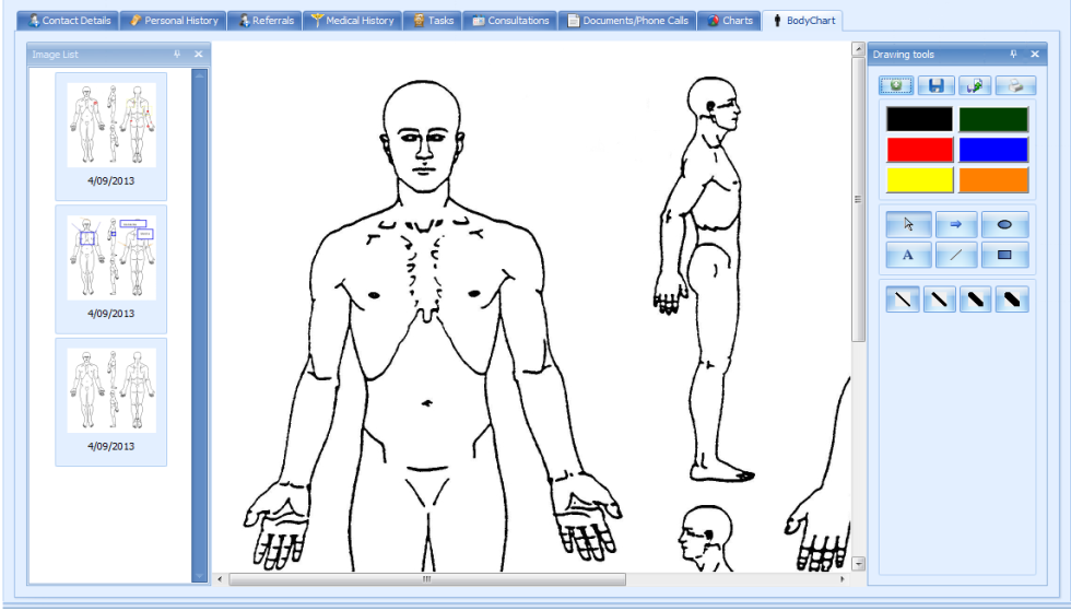 Use the Body Chart