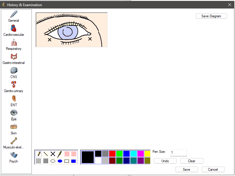 History and Examination Diagram Editor